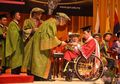 Dulu Jadi Bahan Olok-Olokan Karena Gaya Berjalannya, Kini Banyak yang Kagum dengan Prestasi Pria Ini