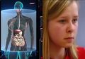 Seperti Superhero Berkekuatan Khusus, Mata Anak Ini Miliki Kemampuan X-Ray dan Terbukti Mampu Mendeteksi Berbagai Penyakit!