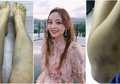 Akhiri Hidup karena Depresi, Pilunya Artis K-Pop Ini Pernah Alami Memar Sekujur Tubuh hingga Pendarahan Rahim karena Ulah Kekasih