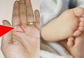 BERITA POPULER: Arti Tanda 'V' Telapak Tangan hingga Suasana Persalinan yang Berubah saat Bayi Ini Lahir