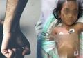 Sering Alami Mimpi Buruk hingga Mengigau Panggil-panggil Nama Budhenya, Bocah 4 Tahun di Surabaya Tak Mampu Tahan Luka Lebam di Sekujur Tubuhnya, Orang Tuanya Beralasan Hanya Keracunan Obat, Ternyata Ini yang Terjadi