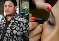 Ivan Gunawan Jadi Saksi Kasus Operasi Lipatan Mata Ilegal: Disebut Bikin Tampilan Lebih Muda, Ternyata Segini Harga Operasi Lipatan Mata