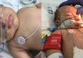 Suami Minta Maaf Hingga Ditangkap Polisi, Gemas Mengguncang Terlalu Keras Sampai Bayi Koma