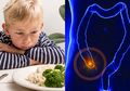 Jangan Sepelekan Bila Anak Kehilangan Selera Makan, Bisa Jadi Tanda Gejala Usus Buntu pada Anak