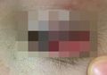 Meski Sepele, Jangan Main Lempar-lemparan Seperti Ini Jika Tak Mau Cidera Mata Layaknya yang Diderita Gadis Berumur 13 Tahun Ini