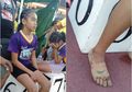 Hati Siapa yang Tak Pilu Melihat Seorang Bocah Buat Sepatu Lari Sendiri dari Perban Bedah, Endingnya Sungguh Tak Terduga