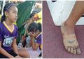 Pakai 'Sepatu Nike' dari Perban, Gadis 11 Tahun Ini Raih 3 Medali Emas di Kompetisi Lari