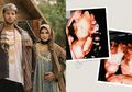 Ammar Zoni Mengaku Omongannya yang Sebabkan Anaknya Meninggal Dunia, Irish Bella: Hati-Hati, Ucapan Itu Doa
