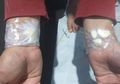 Bawang Putih Hilangkan Sakit Gigi, Cukup Ditempel di Pergelangan Tangan, Rasa Sakit Beralih