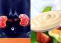 Agar Ginjal Tetap Sehat, Ayo Hindari Konsumsi 5 Makanan Ini, Salah Satunya Mayones