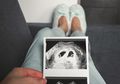 Perut Lebih Besar dari Biasanya Salah Satu Ciri-ciri Mengandung Anak Kembar, Ini Perubahan Lainnya