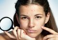 Kulit Bermasalah? Coba Perhatikan Hal-hal Selain Skincare dan Makeup yang Pengaruhi Kondisi Kulit Kamu