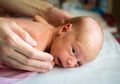Si Kecil yang Terlahir Prematur Rentan Berisiko Alami Kebutaan
