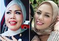 Fakta Potong Gigi Elly Sugigi; Menggindari Larangan KPI juga Menghentikan Hinaan, Hingga Hoax Biayanya Hingga Ratusan Juta