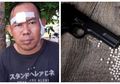 Keterlaluan! Pedagang Kopi Asongan Ini Harus Rasakan Tembakan Brutal Gunakan Senjata Airsoft Gun hingga Alami Luka-luka di Kepala, Ternyata Masalah Sepele Ini yang Jadi Motifnya