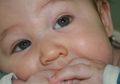 Perhatikan Bayi Anda Apakah Ada Garis Biru Tipis di Antara Alisnya, Benarkah Ada Hubungannya dengan ADHD?