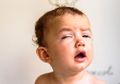 Berita Kesehatan Flu: Jangan Langsung Berikan Obat, Begini 4 Cara Tepat Mengobati Flu pada Bayi