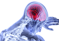Sering Dianggap Sepele, Hal Kecil Ini Ternyata Bisa Jadi Pertanda Orang Terkena Stroke