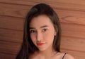 Berubah Terlalu Cantik Akibat Operasi Plastik, Keluarga Wanita Ini Sampai Tidak Bisa Mengenalinya, Rupanya Dulu Seperti Ini Wajahnya
