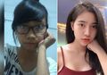 Hasil Operasi Plastik Terlalu Sempurna, Wanita yang Sudah Menjadi Cantik ini Justru Ditolak Keluarganya
