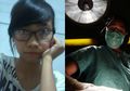 The Power of Plastic Surgery, Lihat Perbedaan Wanita Ini Sebelum dan Sesudah Operasi Plastik Hingga Kenyataan Pahit yang Harus Dia Terima Setelahnya