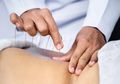 Amankah Melakukan Akupuntur Selama Masa Kehamilan? Berikut Penjelasannya Moms