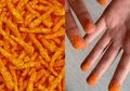 Bingung Nyebut Bumbu Cheetos yang Nempel di Jari? Ini Nih Namanya