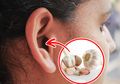 7 Cara Mengobati Sakit Telinga Secara Alami, Jangan Sampai meradang dan Infeksi, Termasuk Menggunakan Bawang Putih, Yuk Intip Caranya!