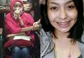 Awalnya Dikira Cuma Sariawan, Kanker Lidah Renggut Nyawa Artis Cantik Ini, Makanan dan Minuman Seperti Ini Ternyata Bisa Picu Penyakit Mematikan Tersebut