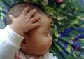 Bayi Suka Menggaruk Kepala Ditempat yang Sama Itu Tandanya Ada Sesuatu, Seperti Bayi 7 Bulan Ini yang Ternyata Menurut Dokter Menderita Otitis Media