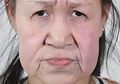 Dulu Jadi Bahan Olok-Olokan, Karena Baru 15 Tahun Wajahnya Keriputan Seperti Nenek-nenek, Setelah Operasi Plastik Penampilannya Membuat Semua Orang Terkagum-kagum