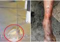 Sedang Tidur di Taman, Tunawisma Dibakar Seorang Pria, Dengan Wajah Tak Berdosa Pelaku Kembali dan Ikut Bantu Padamkan Api