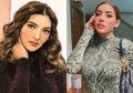 Sudah Operasi Payudara di Thailand, Millen Cyrus Sempat Tak Terima Saat Disemprot Ashanty, Sebut Sang Tante Penuh Kepalsuan: Dia Jaga Image, Padahal Aslinya...