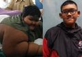 Bukan Ade Rai, Melainkan Operasi Inilah yang Jadi Kunci Utama Arya Permana Turunkan Berat Badan Hingga 109 Kg, Bisa Bikin Gampang Kenyang?