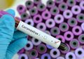 Indonesia Masih Nihil Kasus Virus Corona, Hingga Disebut Tak Bisa Mendeteksinya, Kemenkes Justru Ungkap Fakta Ini, 'Virusnya Mungkin Ada, Tapi Orang Indonesia Lebih Sehat'