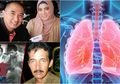Berita Terpopuler: Alasan Jane Shalimar Mau Dinikahi Arsya Wijaya hingga 10 Makanan yang Buat Paru-Paru Tetap Sehat