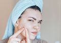 Cara Mengatasi Fungal Acne, Ini Tips Skincare yang Harus Kamu Perhatikan!