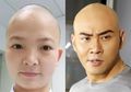 Perawat Ini Cukur Habis Rambutnya hingga Terlihat seperti Deddy Corbuzier, Alasannya Sungguh Tak Terduga!
