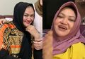Hasil Autopsi Lina Jubaedah Sudah Keluar, Stres Berkepanjangan Bisa Picu Asam Lambung dan Hipertensi Kronis Seperti Mantan Istri Sule