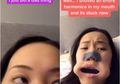 Pengguna TikTok Ini Harus Dibawa ke Rumah Sakit karena Harmonika Nyangkut di Mulutnya