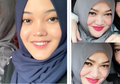 Berita Hasil Otopsi Lina: Polisi Ungkap Fakta Tentang Lebam di Tubuh Jenazah Lina Jubaedah yang Dianggap Janggal