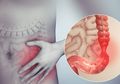 Ini Gejala Maag Akut, Termasuk Tidak Mau Makan dan Merasa Mudah Kenyang
