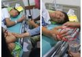 Dibully Temannya Sendiri, Jari Siswa SMP di Malang ini Sampai Bengkak dan Membiru, Netizen: Pengobatan Mungkin Tak Seberapa, Tapi Kesehatan Jiwa Siapa yang Gantiin!