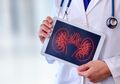 4 Minuman yang Baik untuk Mendetoks Ginjal agar Tetap Sehat