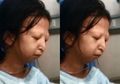 Rela Tanam Bom Waktu di Dirinya Sendiri Demi Pengobatan Sang Adik, Gadis Ini Akhirnya Meninggal Dunia Setelah Hanya Konsumsi Nasi dan Sambal Selama 5 Tahun, Cuma Ada Uang Rp 3900 Perhari untuk Makan