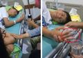 Sungguh Nahas, Jari Anak SMP di Malang Ini akan segera Diamputasi akibat Dibully Temannya, Dua Sosok Penting Ini Malah Sebut Itu Hanya Candaan