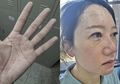 Dedikasi Tanpa Batas! Beginilah Kondisi Petugas Medis yang Bantu Pasien Virus Corona di Wuhan, Tangan Keriput hingga Tidur di Lantai