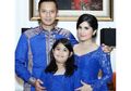 Duduk di Kursi Roda, Putri Annisa Pohan Alami Cidera Patah Tulang