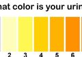 Jangan Disepelekan, Warna Urine Ternyata Bisa Ungkap Keadaan Tubuh!