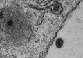 Kepanikan Virus Corona Belum Mereda, Ilmuwan Geger Karena Temukan Virus Misterius Baru: Gennya Sama Sekali Tidak Dikenal Oleh Ilmuwan
